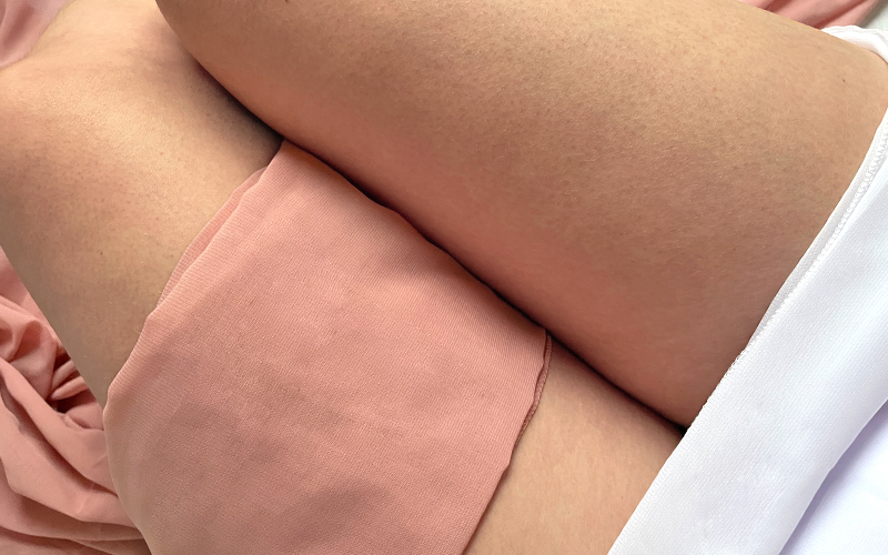 Cellulite-Check-Up zur Analyse deines Bindegewebes und deiner Gewohnheiten